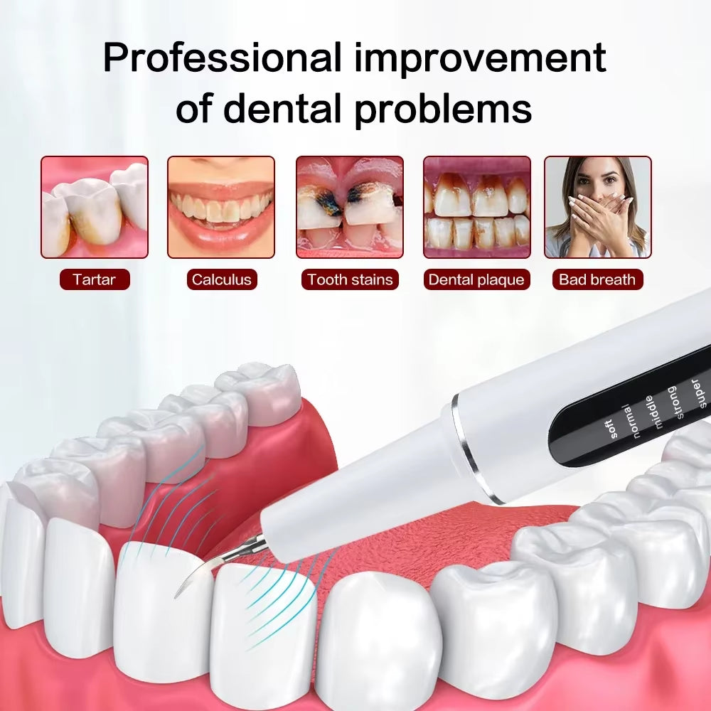 Ultra Sonic Tooth Plaque Cleaner