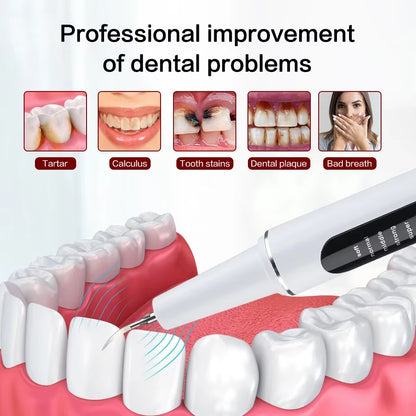 Ultra Sonic Tooth Plaque Cleaner