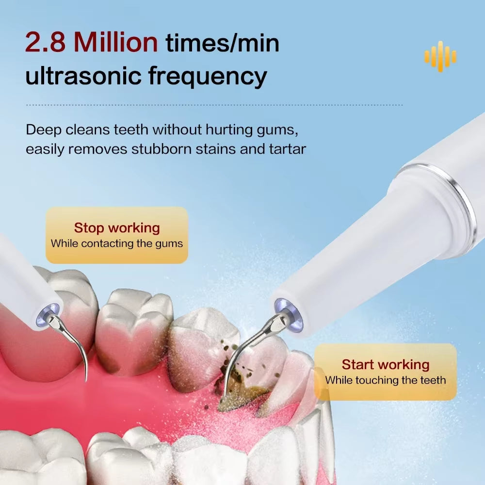 Ultra Sonic Tooth Plaque Cleaner
