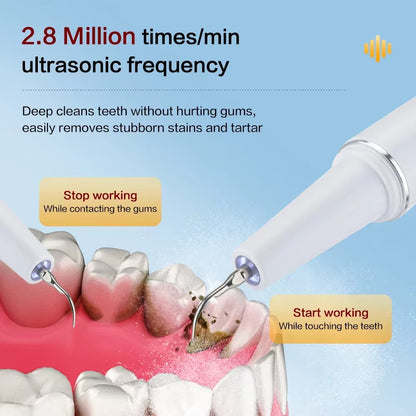 Ultra Sonic Tooth Plaque Cleaner